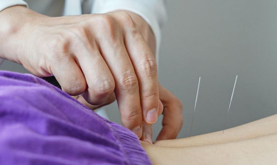 Brasil regulamenta exerc�cio profissional da acupuntura